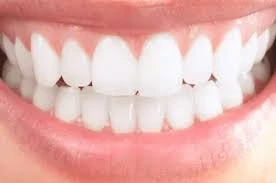 Limpieza Dental con Ultrasonido