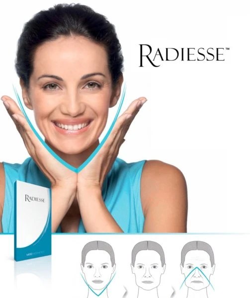 radiesse-lifting-503x600.webp