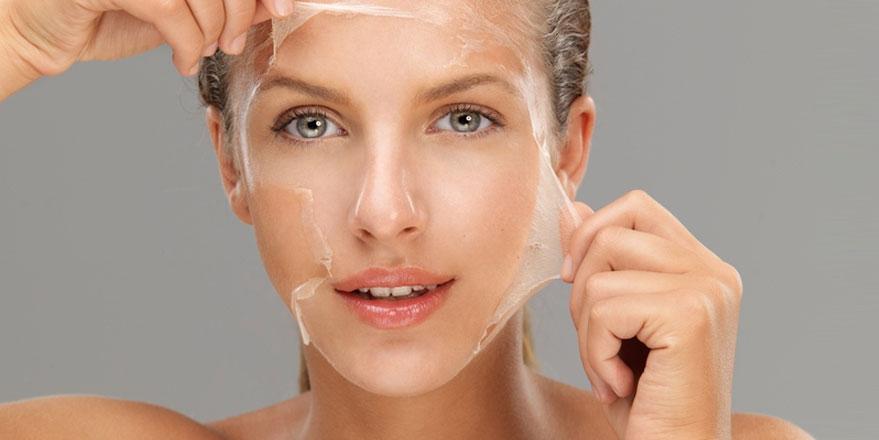 Peeling