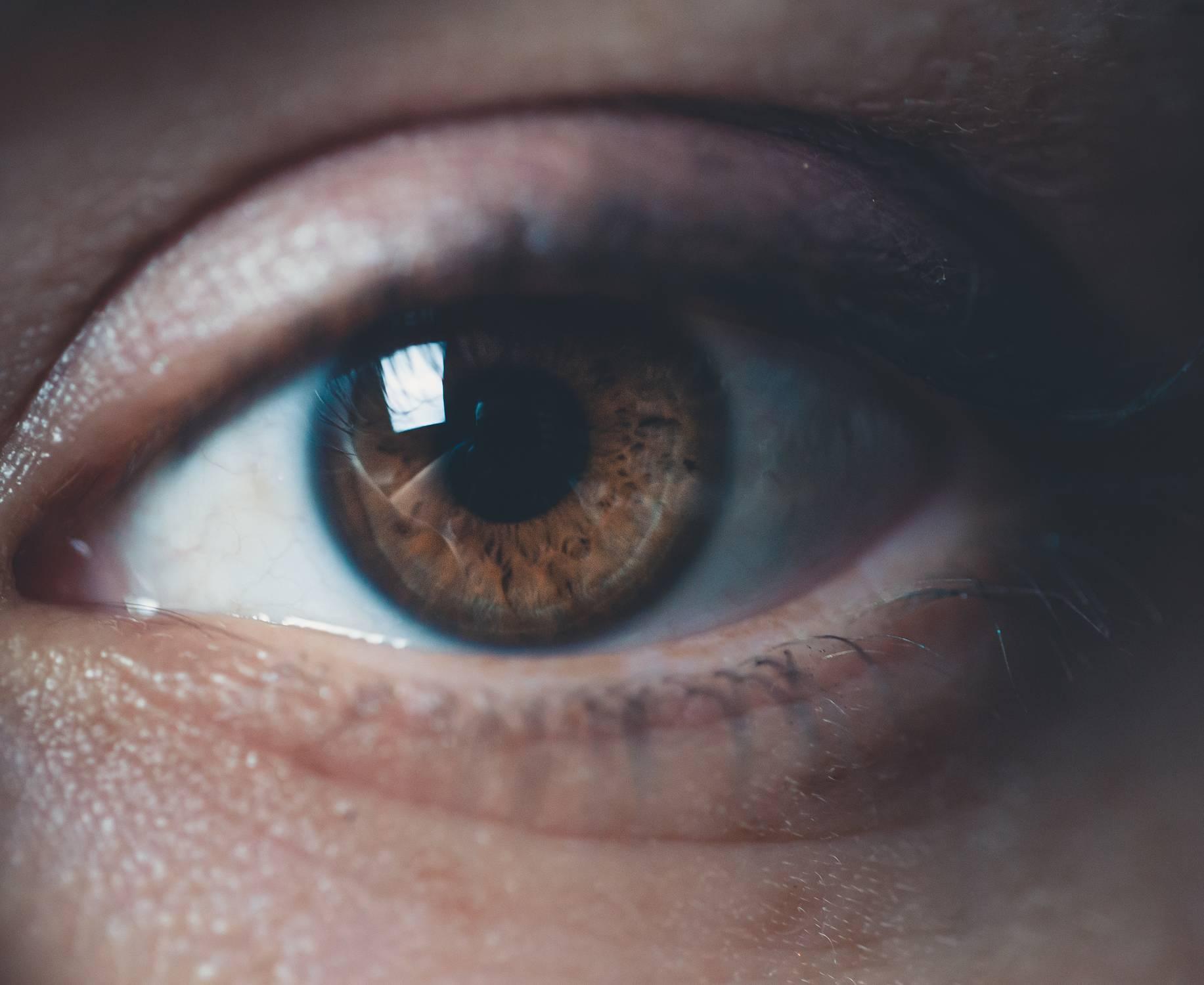 ¿Qué es el ojo seco?
