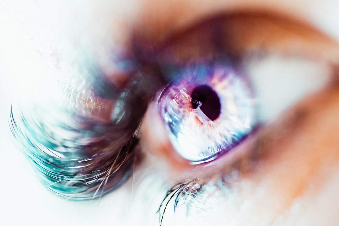Glaucoma