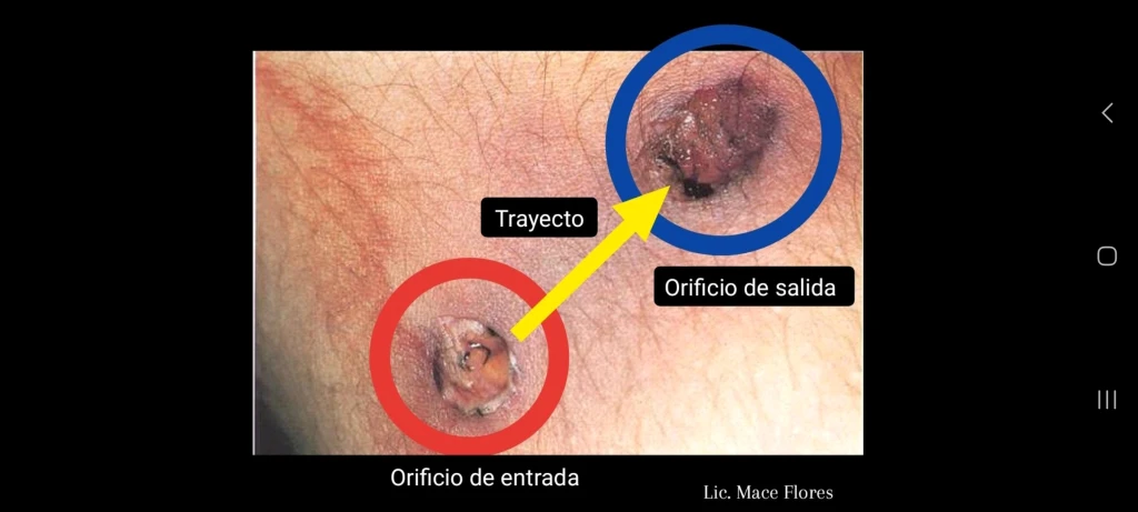 Medicina Legal 2023 ISSP