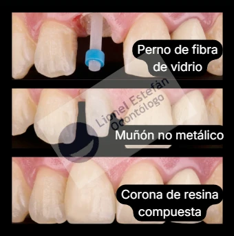 pernocorona-(2174).webp