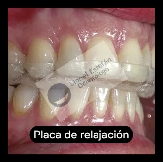 placaderelajacion-(2771).webp