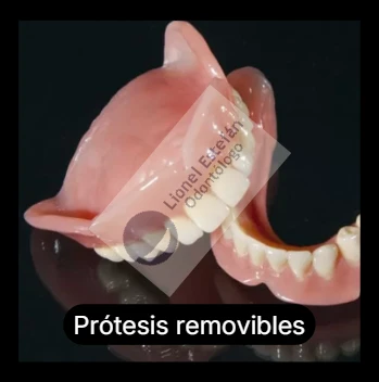 prtesisdentales-(4965).webp