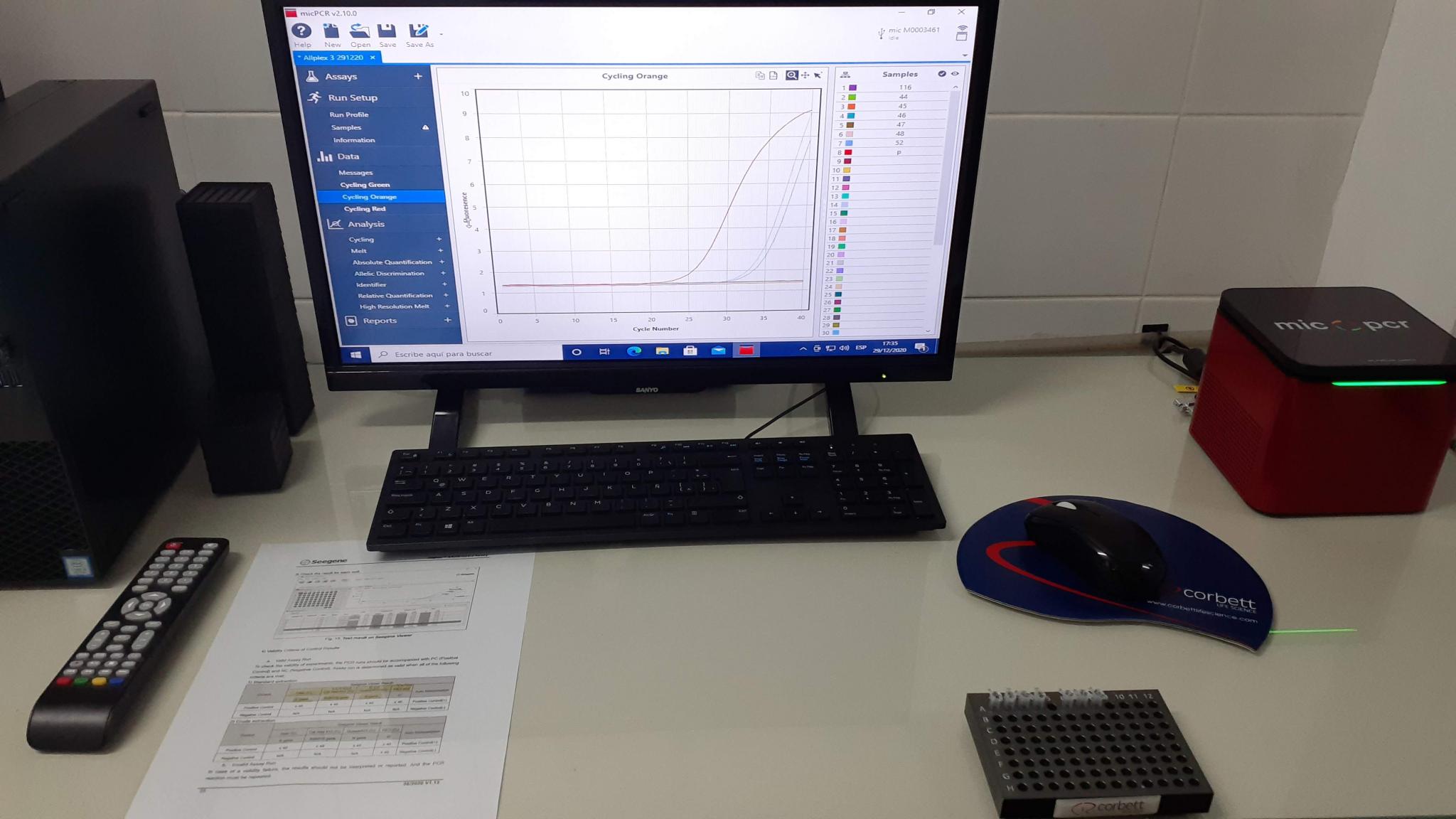 Análisis test coronavirus CoV19
