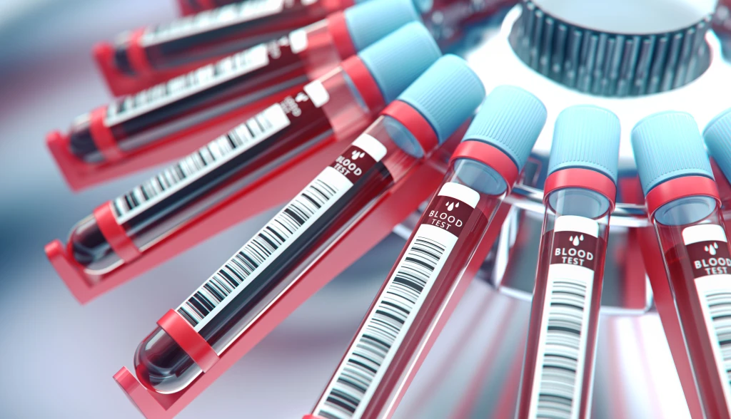 1140-blood-test-results-esp.webp