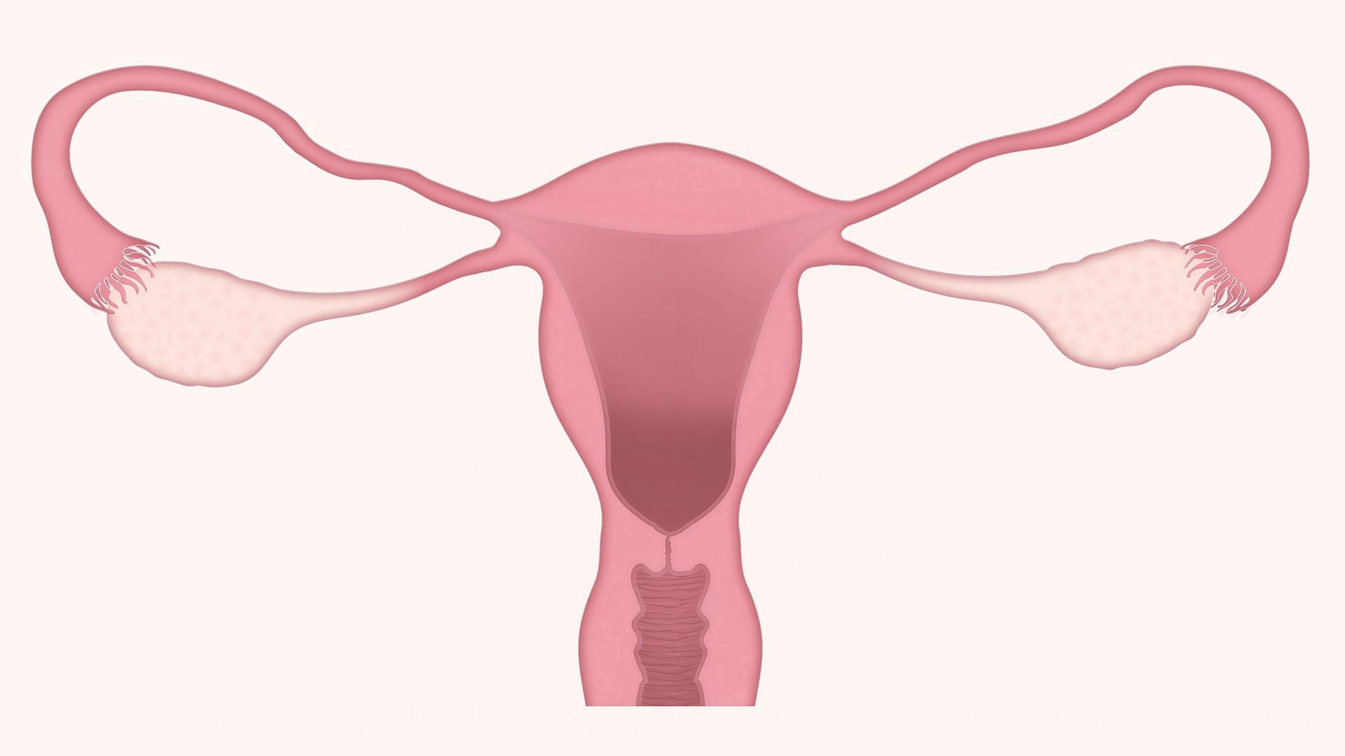  DÍA MUNDIAL DEL CÁNCER DE OVARIO