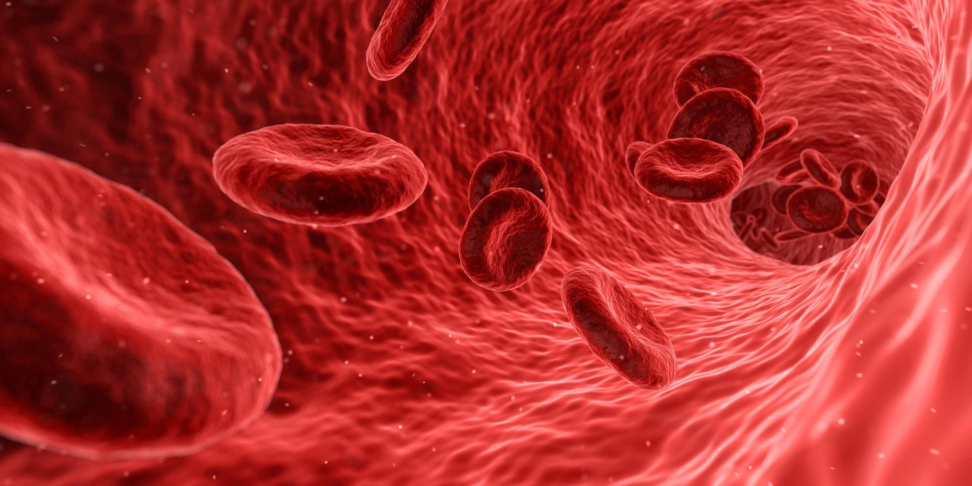 TALASEMIA