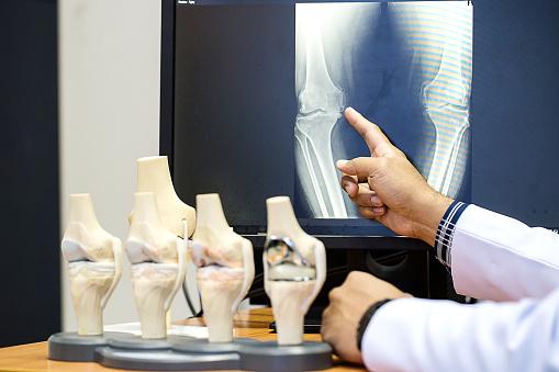  DÍA MUNDIAL DE OSTEOPOROSIS