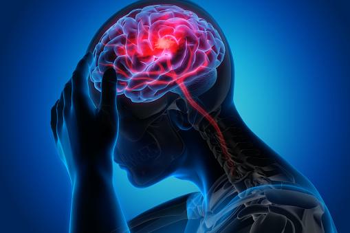 ACCIDENTE CEREBROVASCULAR