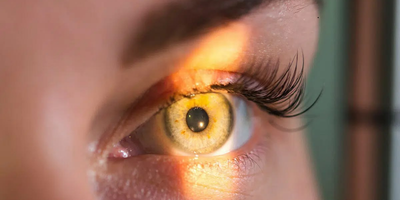 glaucoma