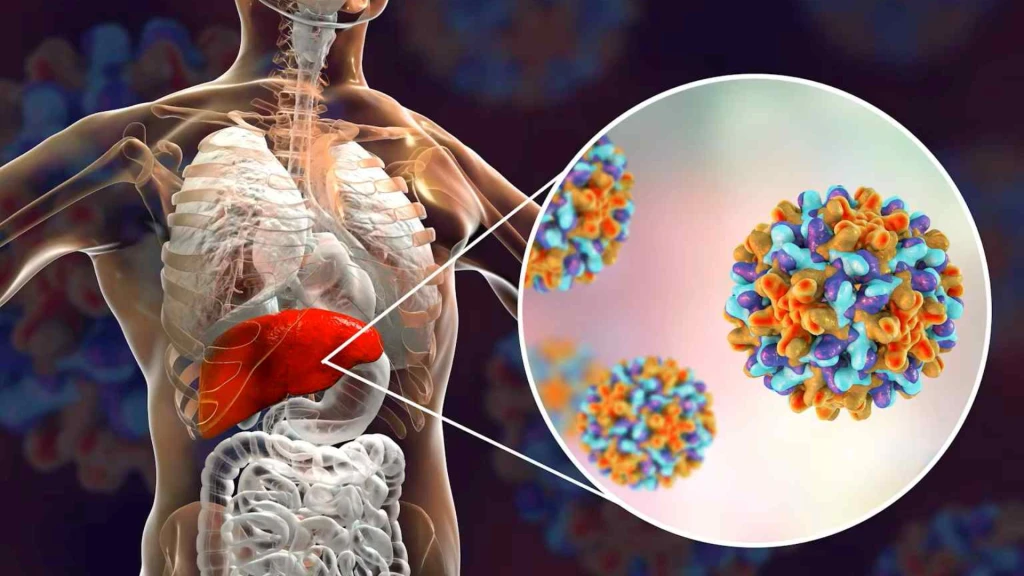 Resultados de la fase 3 del tratamiento con bepirovirsen para la infección crónica por el virus de la hepatitis B.