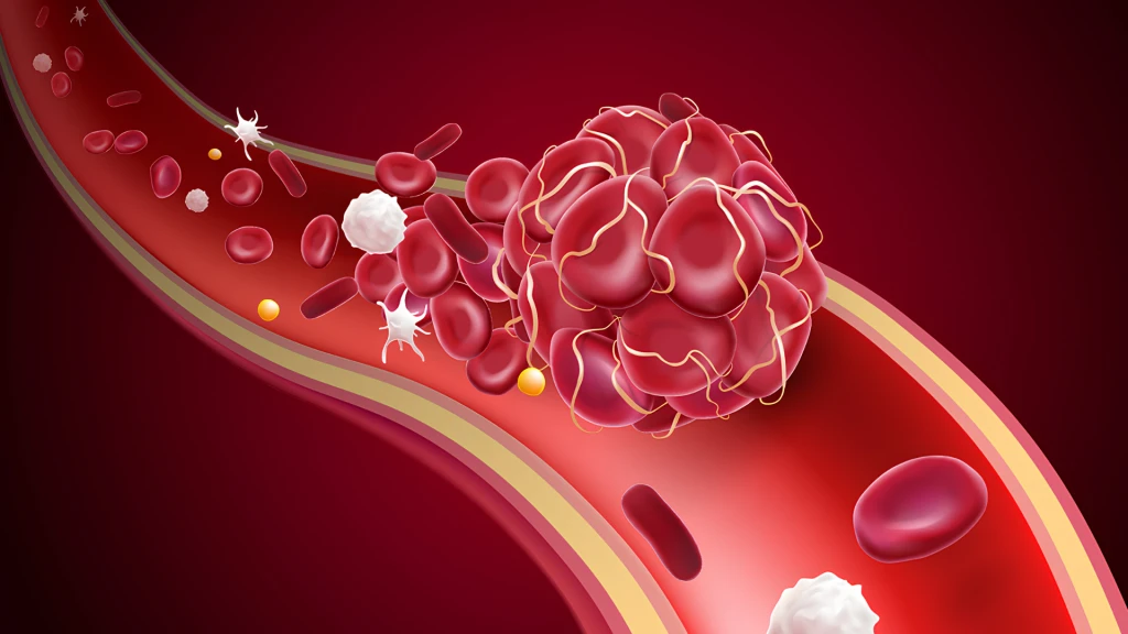 Anticoagulantes orales directos, AINE selectivos de la COX-2 y hemorragia gastrointestinal en la fibrilación auricular.