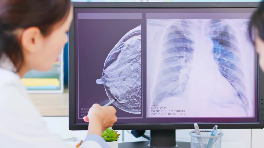 Retraso en el diagnóstico de cáncer asociada con un ensayo de cribado poblacional mediante una prueba de detección temprana de múltiples tipos de cáncer.