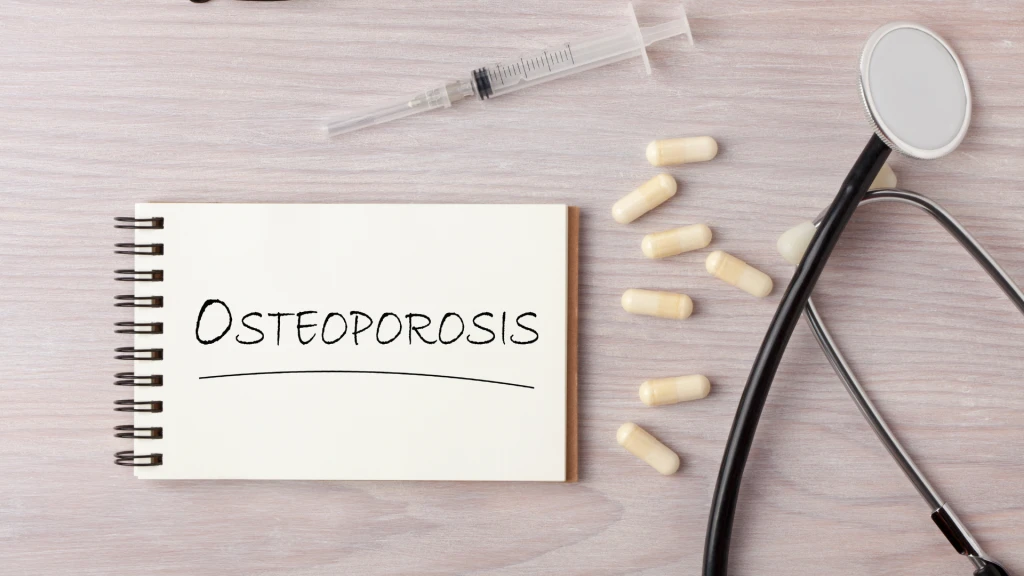 Efectos de la medicación antiosteoporótica sobre la consolidación de fracturas y sus resultados.