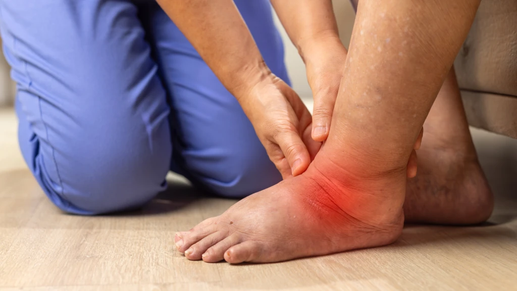 Edema periférico inducido por fármacos: un daño común, a menudo pasado por alto y reversible.