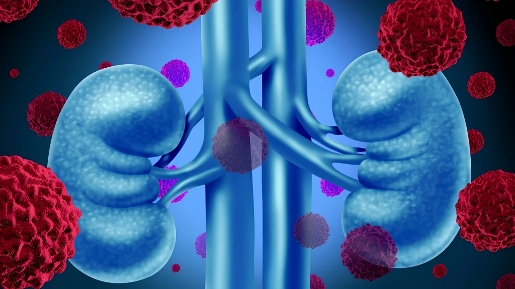 Tratamiento adyuvante con pembrolizumab y belzutifan para el carcinoma de células renales