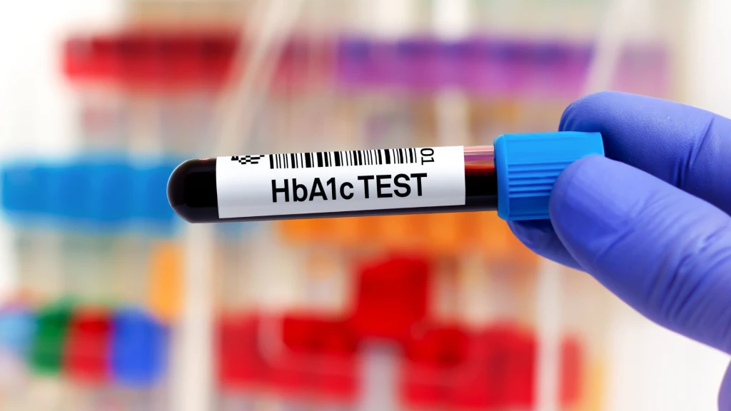 Frecuencia adecuada de la prueba de hemoglobina A1c para monitorizar a pacientes con diabetes tipo 2.