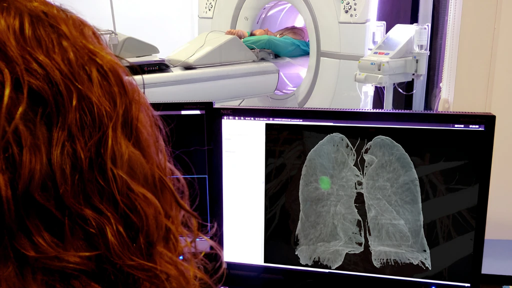 Beneficios y perjuicios de las estrategias de cribado de cáncer de pulmón en Argentina: un estudio de modelización.