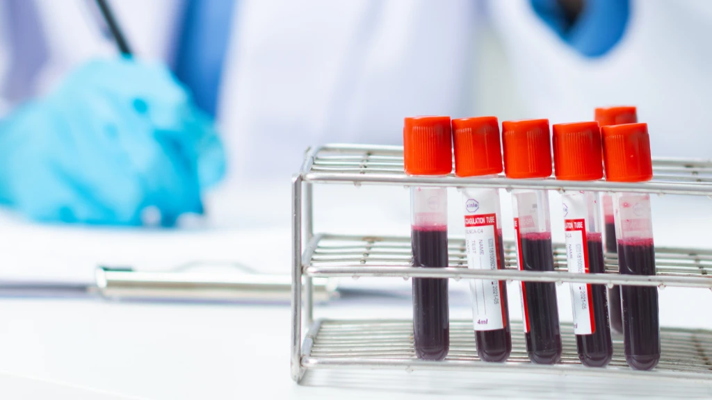 Carga de enfermedad cardiovascular atribuible al plomo.
