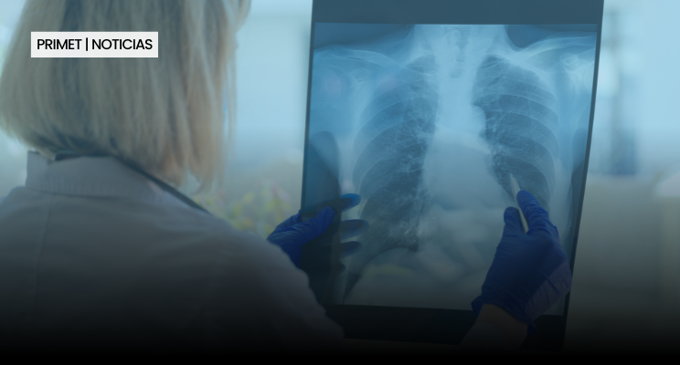 EPOC: LA ENFERMEDAD SILENCIOSA QUE TAMBIÉN AFECTA AL ÁMBITO LABORAL