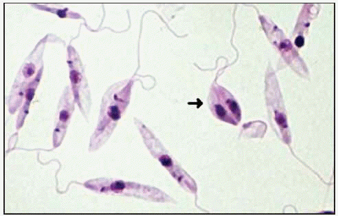 Indicaciones para la Leishmaniasis
