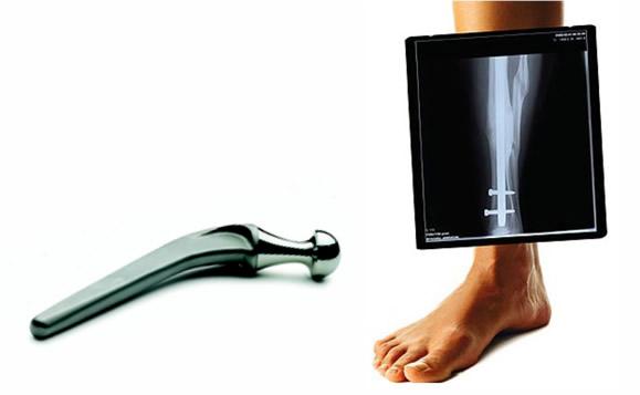 tubos Implantes quirúrgicos implantes quirúrgicos