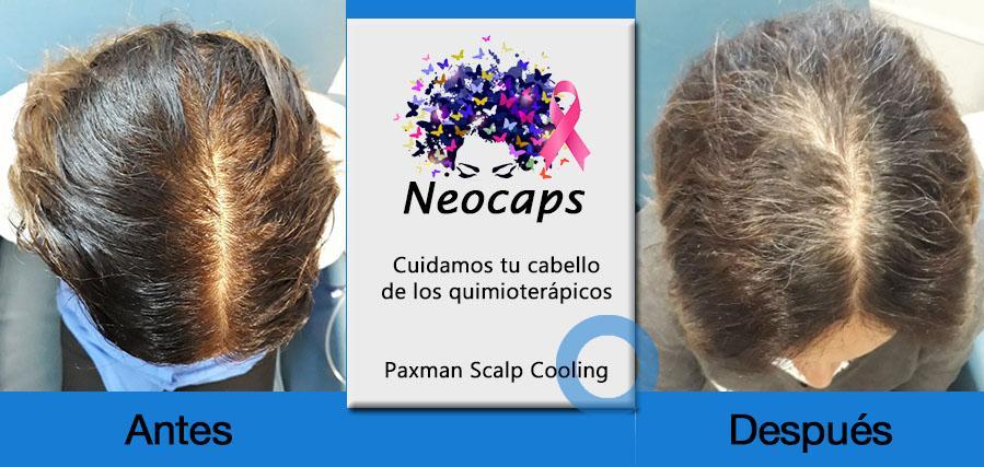 testimonios
