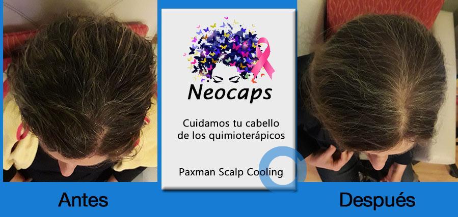 testimonios